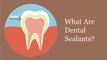 What Are Dental Sealants