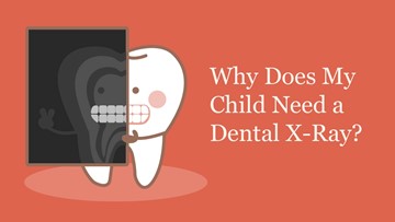 Why Does My Child Need A Dental Xray